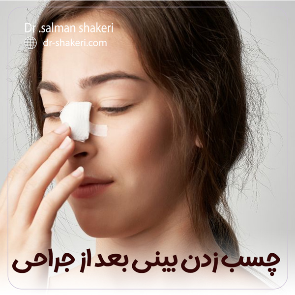 چسب زدن بینی - دکتر سلمان شاکری