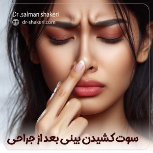 سوت کشیدن بینی بعد از جراحی - دکتر سلمان شاکری