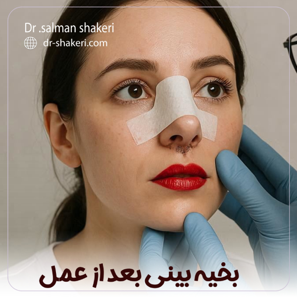 بخیه بینی بعد از عمل - دکتر سلمان شاکری