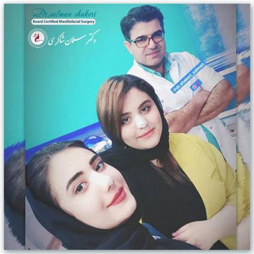 جراحی بینی 92