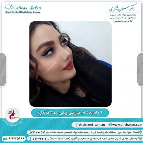 جراحی بینی 95